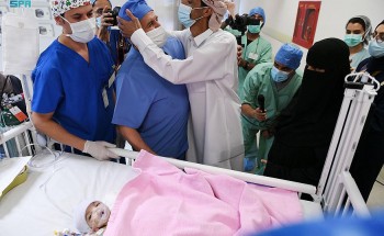 الدكتور الربيعة يعلن نجاح عملية فصل التوأم الطفيلي اليمني