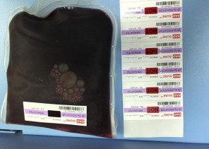 بنك الدم المركزي بصحة المدينة المنورة يطلق خدمة أكياس الدم المشعة